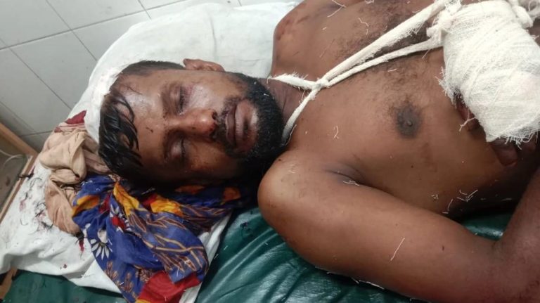 নাগরপুরে স‘মিল শ্রমিককে কুপিয়ে আহত করেছে কিশোর গ্যাং এর সদস্যরা
